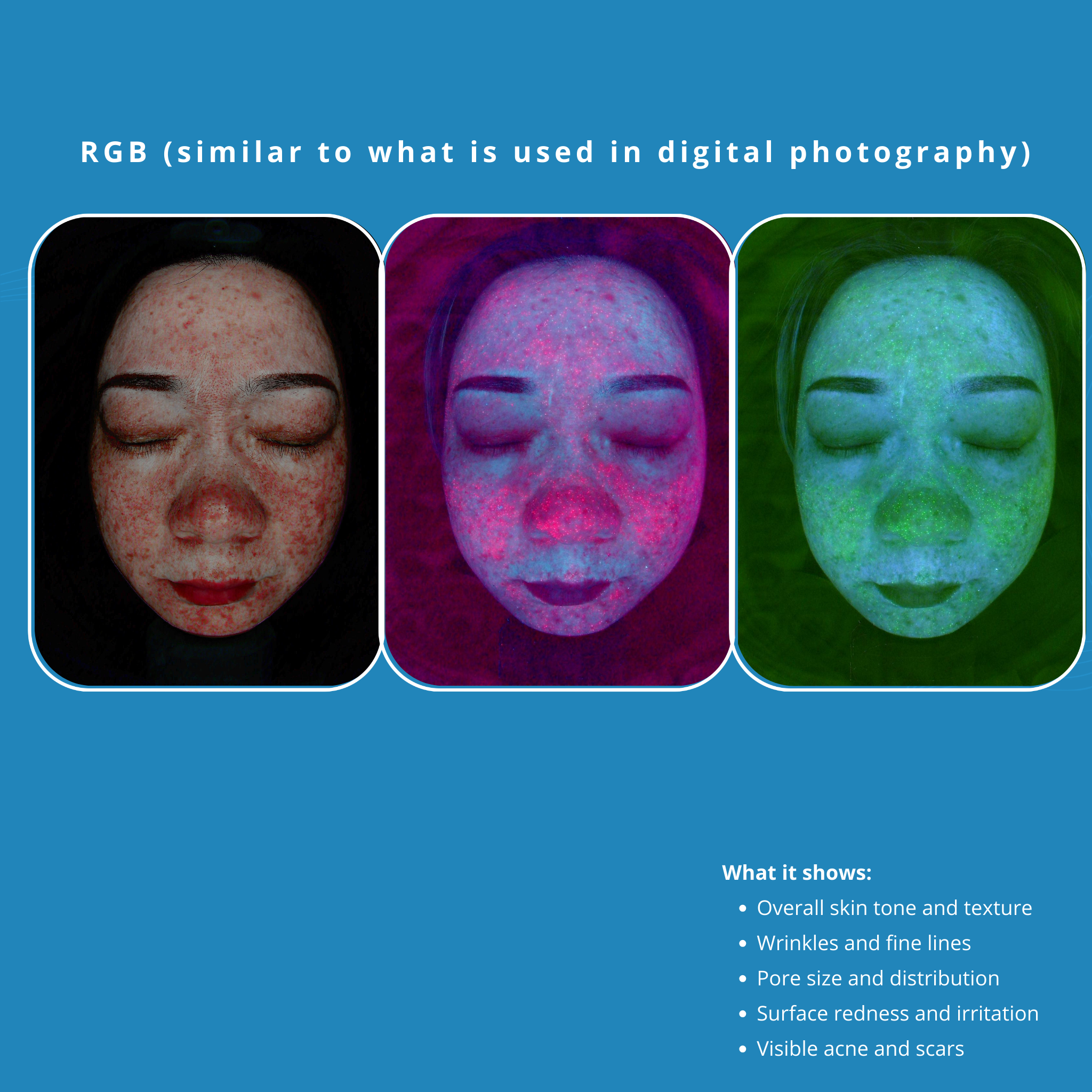 Skincare Analysis Device with Scalp Analysis powered by AI Model S5 VMS SOLUTIONS SHOP