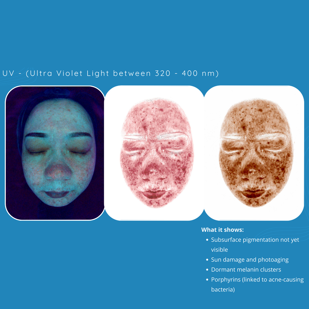 Skincare Analysis Device with Scalp Analysis powered by AI Model S5 VMS SOLUTIONS SHOP