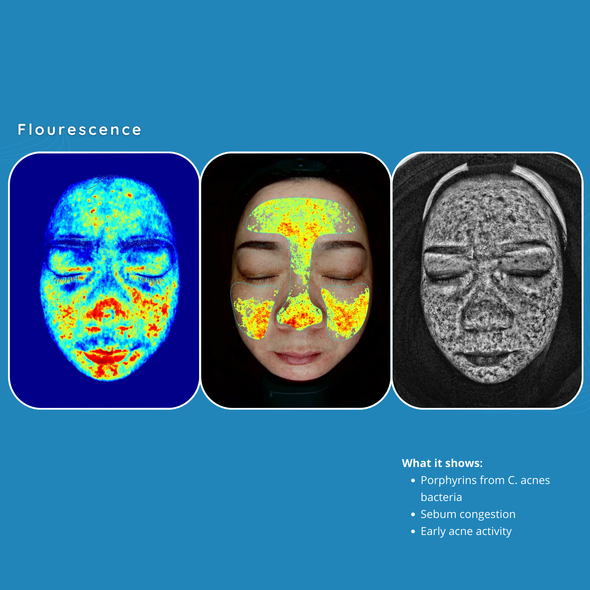 Skincare Analysis Device with Scalp Analysis powered by AI Model S5 VMS SOLUTIONS SHOP