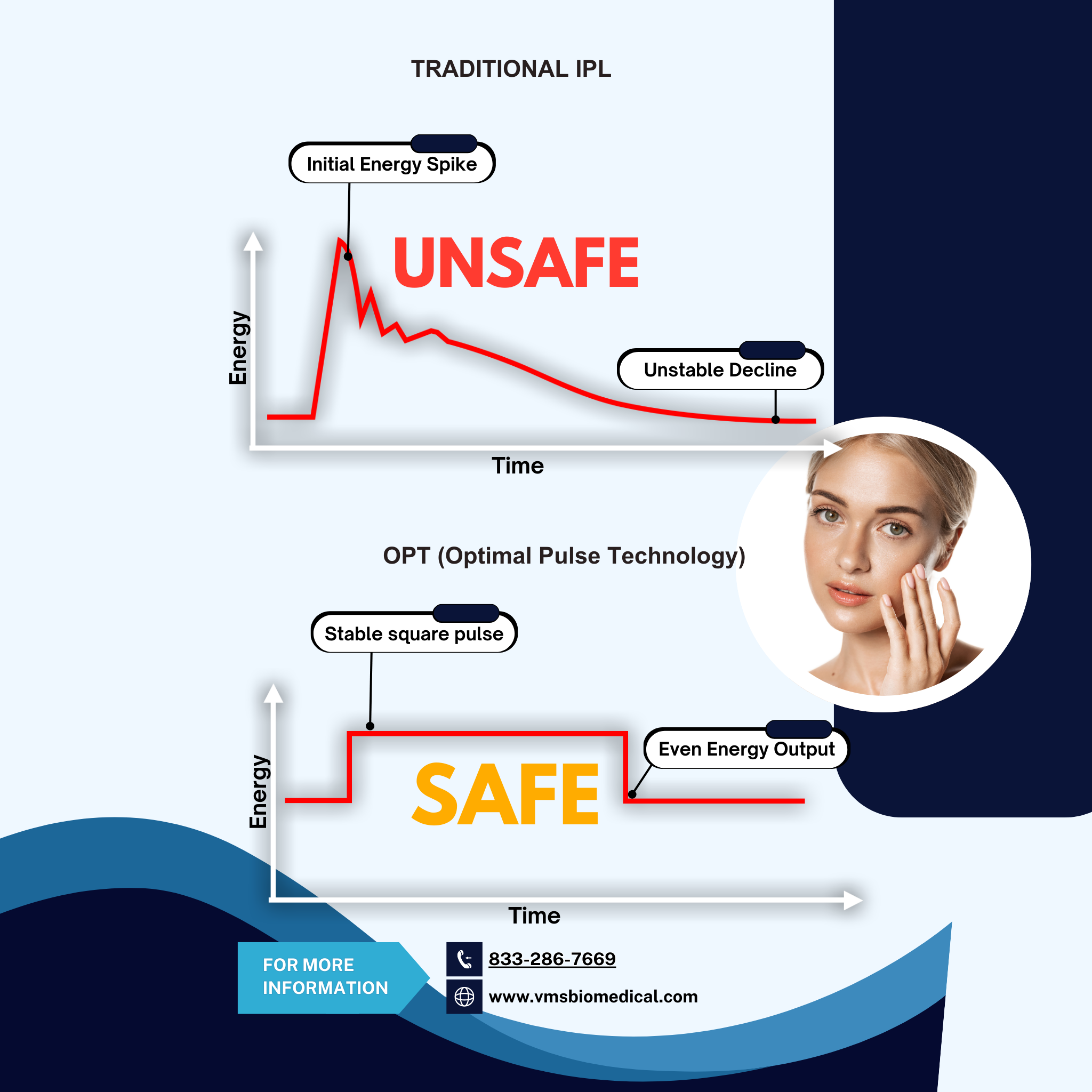 Impulx3™ IPL Machine | Lumecca & BBL Hero Alternative | OPT SHR for All Skin Types VMS (Ventura Medtech Solutions) Online Store for Content and Products