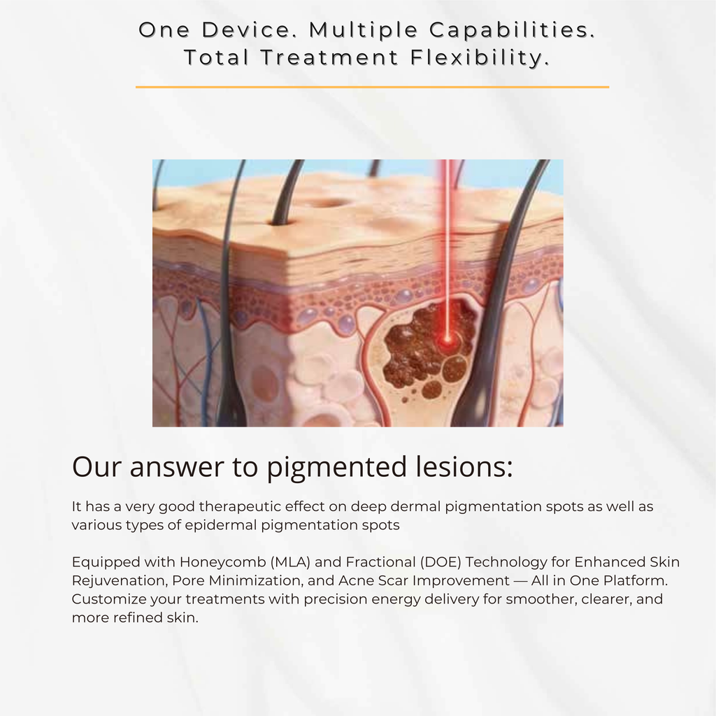 Q-Switched Nd:YAG Laser System for Tattoo Removal & Pigmentation Treatments VMS (Ventura Medtech Solutions) Online Store for Content and Products