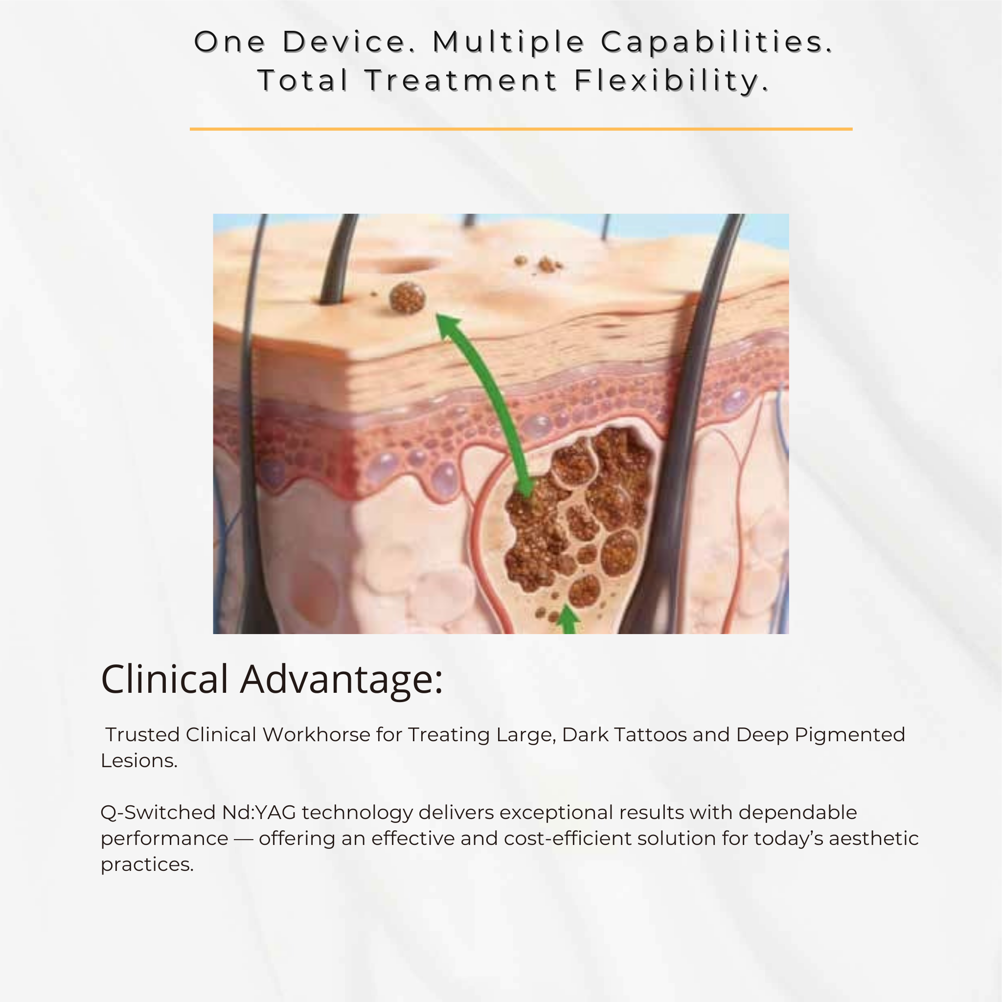 Q-Switched Nd:YAG Laser System for Tattoo Removal & Pigmentation Treatments VMS (Ventura Medtech Solutions) Online Store for Content and Products