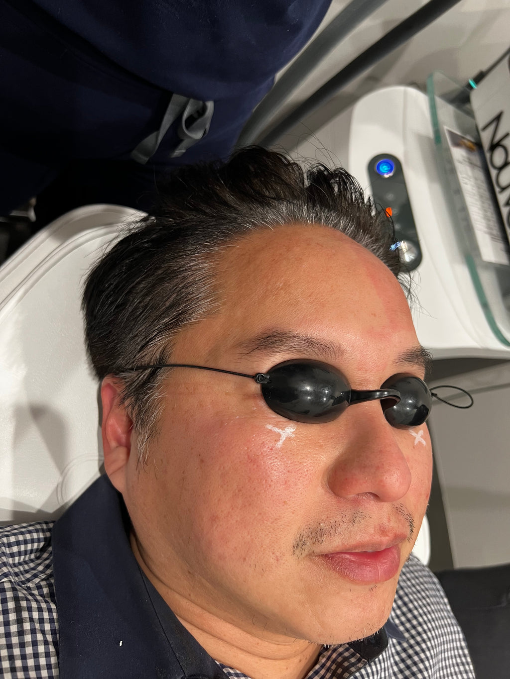 NOUVERE ERBIUM GLASS LASER FOR ADVANCED SKIN REJUVENATION and Hair Regrowth
