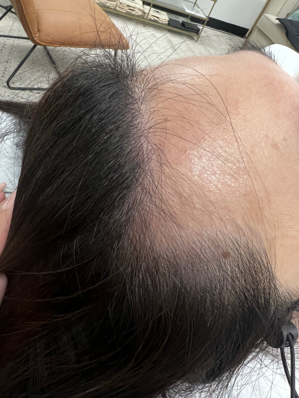 NOUVERE ERBIUM GLASS LASER FOR ADVANCED SKIN REJUVENATION and Hair Regrowth