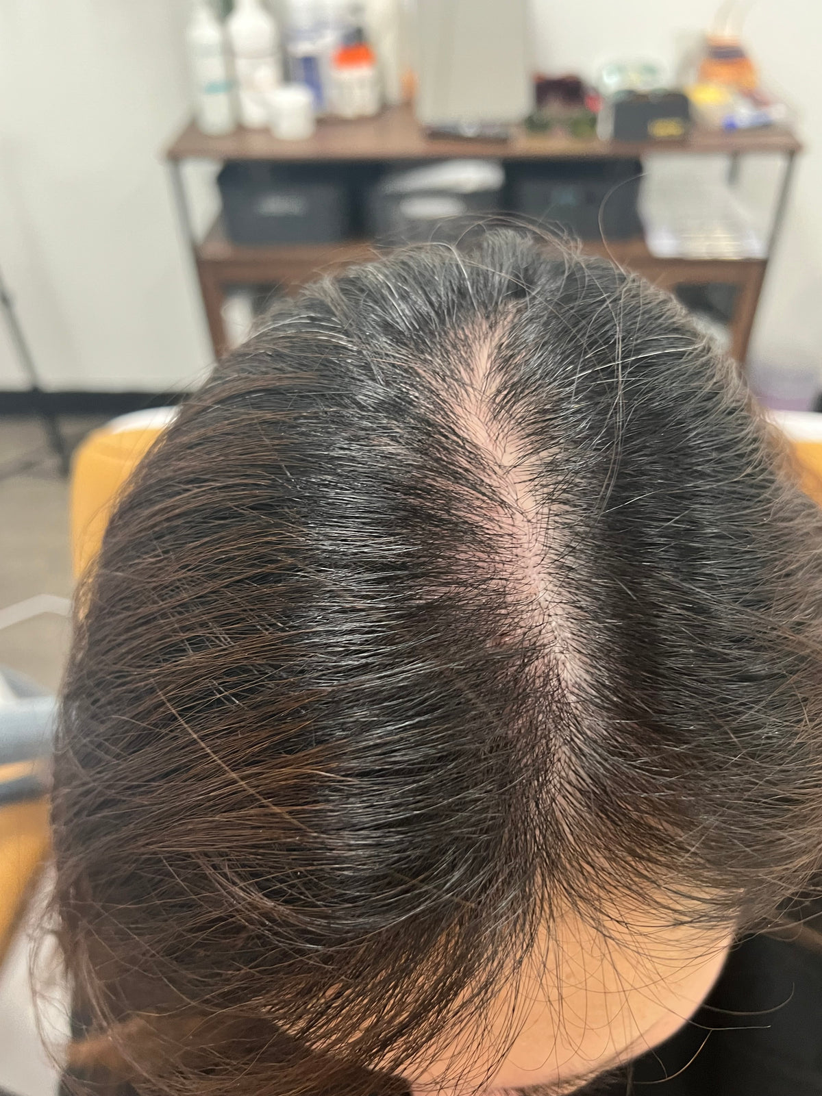 NOUVERE ERBIUM GLASS LASER FOR ADVANCED SKIN REJUVENATION and Hair Regrowth