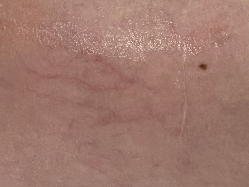 Impulx3™ IPL Machine | Lumecca & NBL Hero Alternative | OPT SHR for All Skin Types VMS (Ventura Medtech Solutions) Online Store for Content and Products
