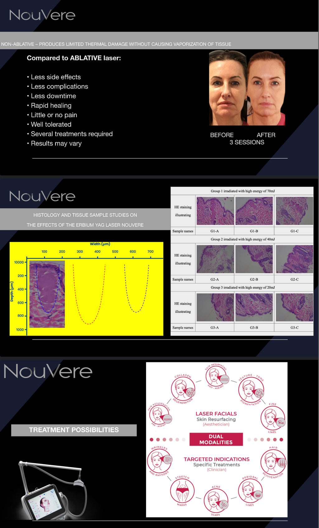 NOUVERE ERBIUM GLASS LASER FOR ADVANCED SKIN REJUVENATION and Hair Regrowth