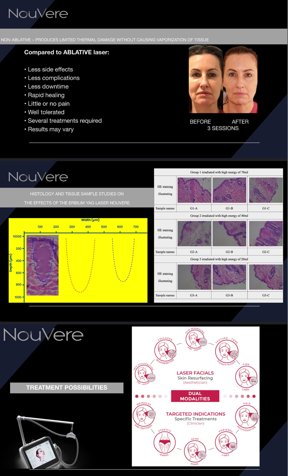 NOUVERE ERBIUM GLASS LASER FOR ADVANCED SKIN REJUVENATION and Hair Regrowth