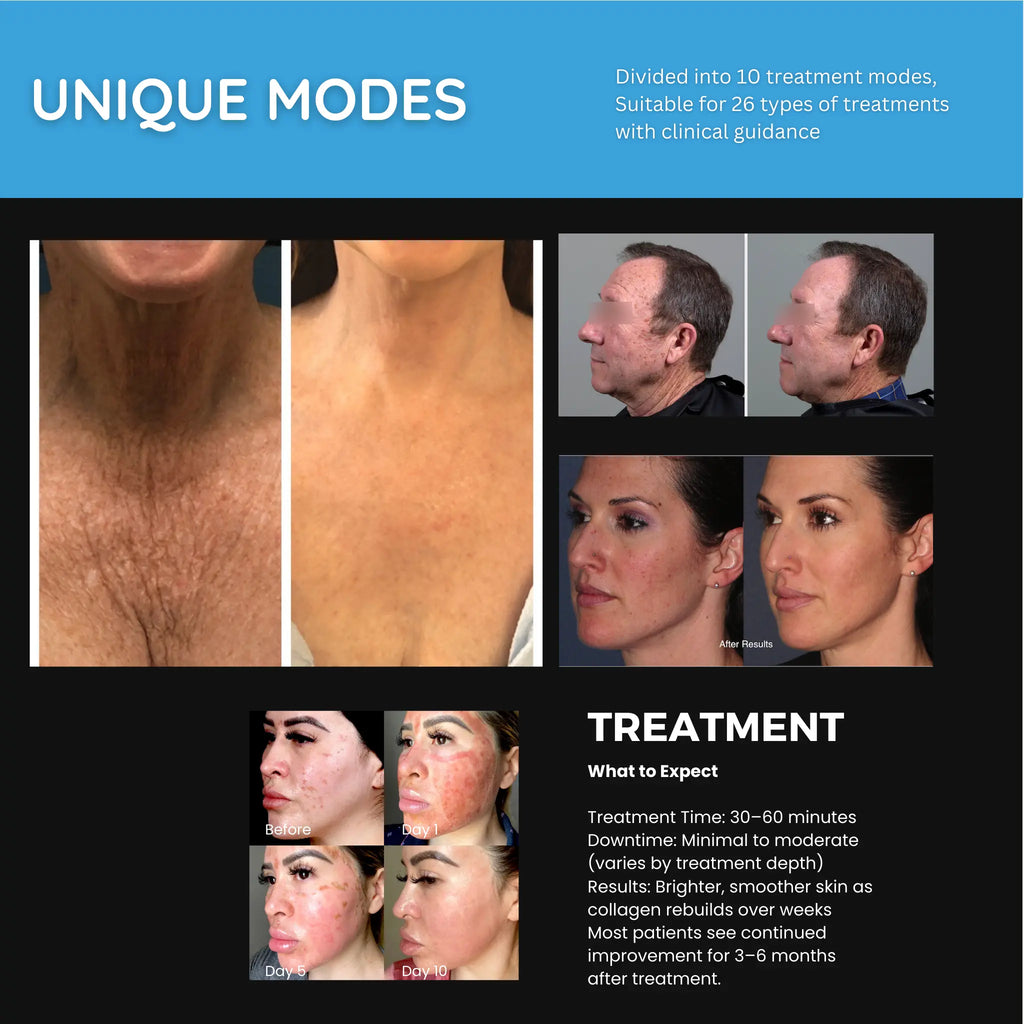 Revo CO₂ Laser | Fractional CO2 Skin Resurfacing System | designed for Surgeons and Aesthetic Providers VMS SOLUTIONS SHOP
