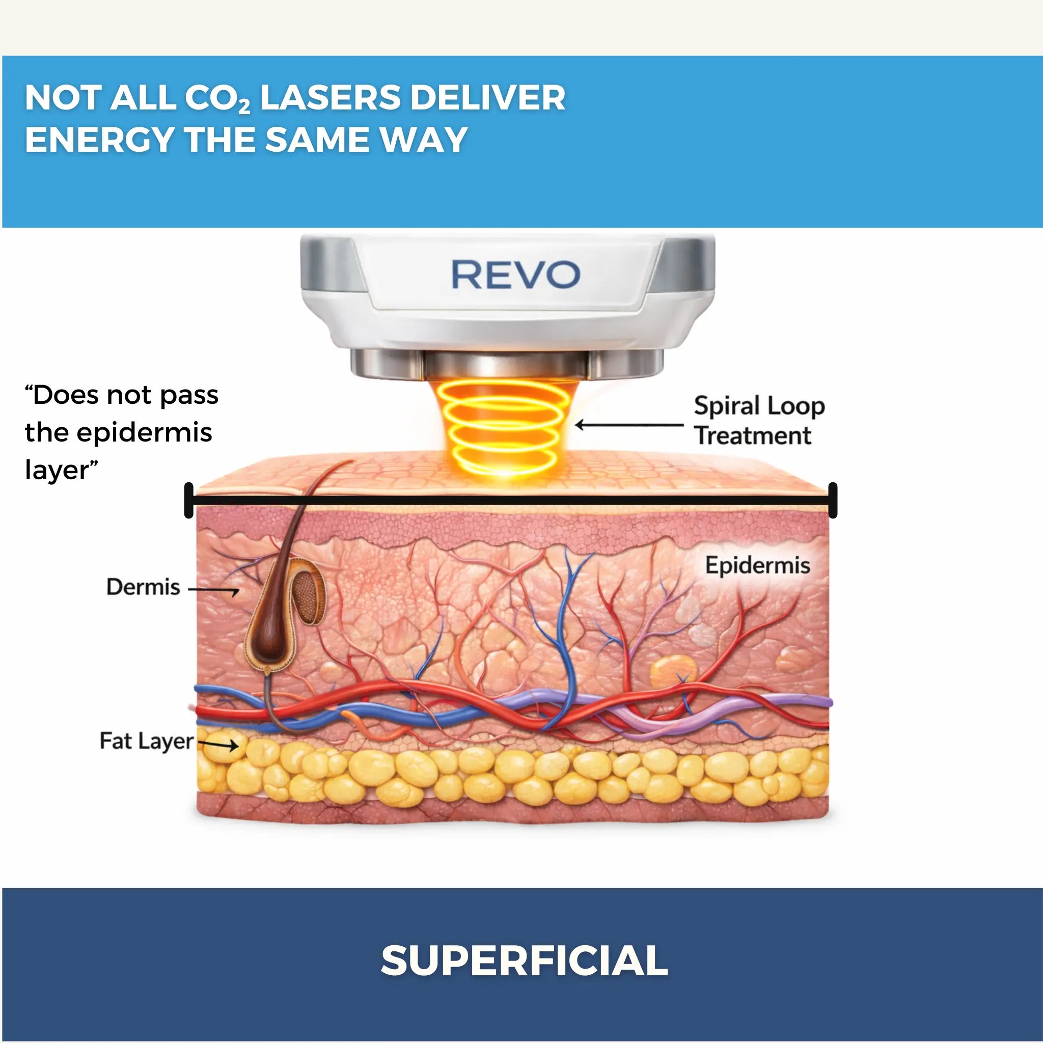 Revo CO₂ Laser | Fractional CO2 Skin Resurfacing System | designed for Surgeons and Aesthetic Providers VMS SOLUTIONS SHOP