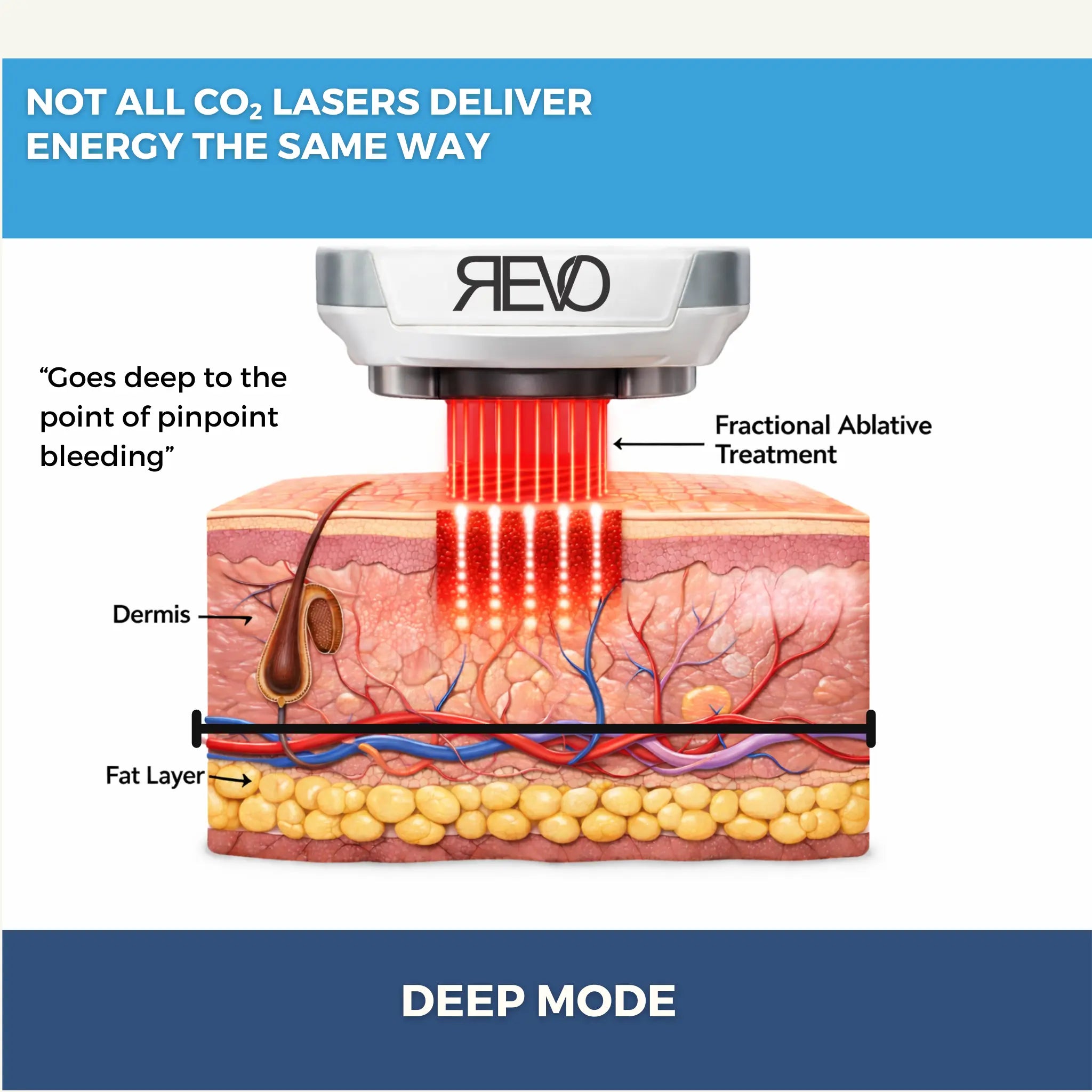 Revo CO₂ Laser | Fractional CO2 Skin Resurfacing System | designed for Surgeons and Aesthetic Providers VMS SOLUTIONS SHOP