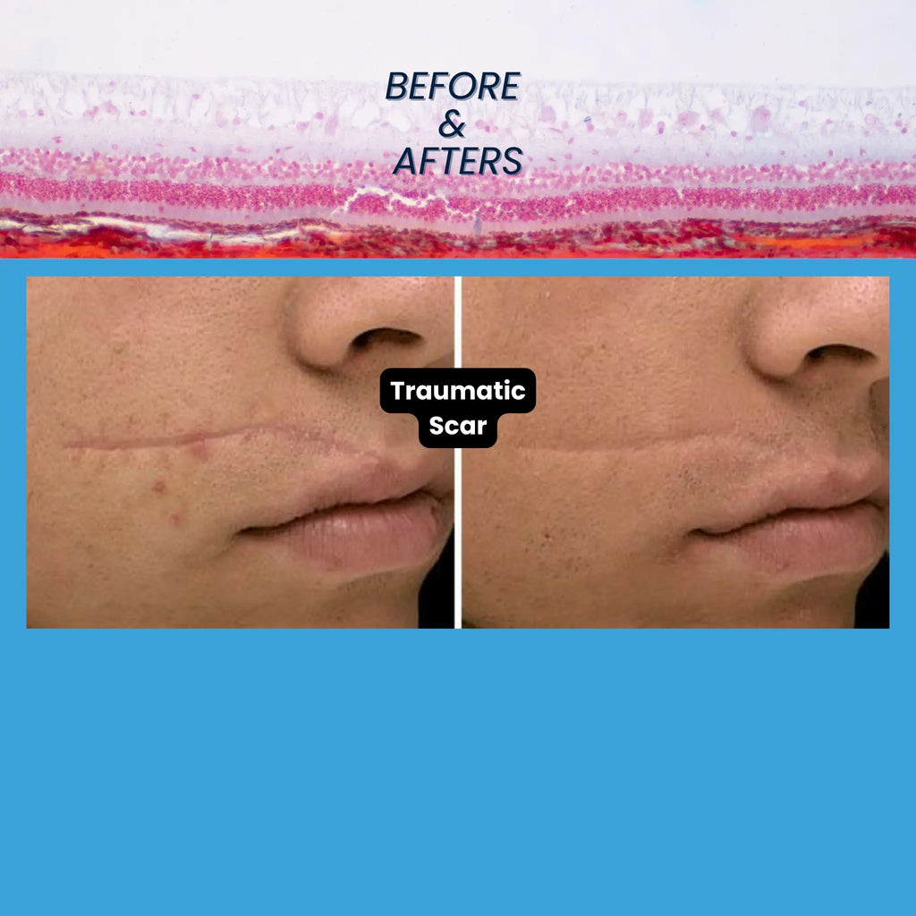 Revo CO₂ Laser | Fractional CO2 Skin Resurfacing System | designed for Surgeons and Aesthetic Providers VMS SOLUTIONS SHOP