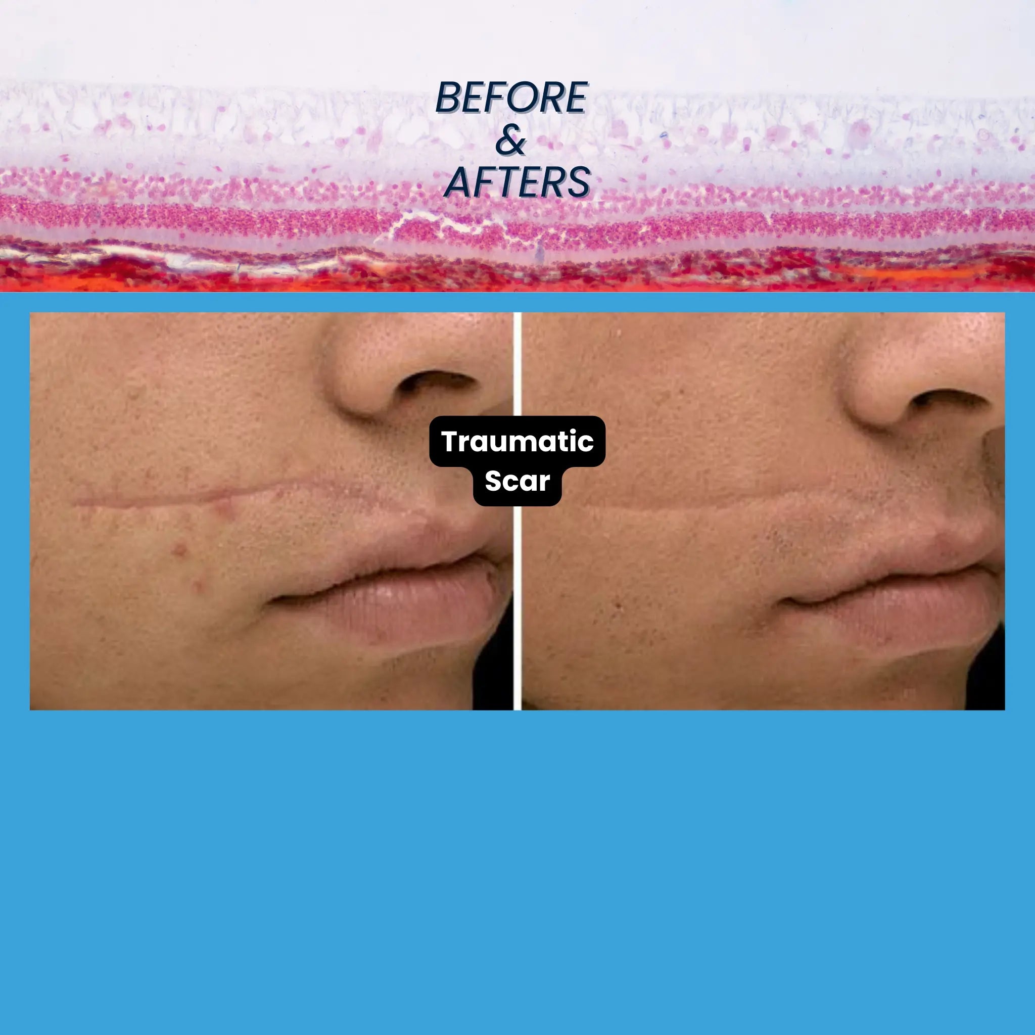 Revo CO₂ Laser | Fractional CO2 Skin Resurfacing System | designed for Surgeons and Aesthetic Providers VMS SOLUTIONS SHOP