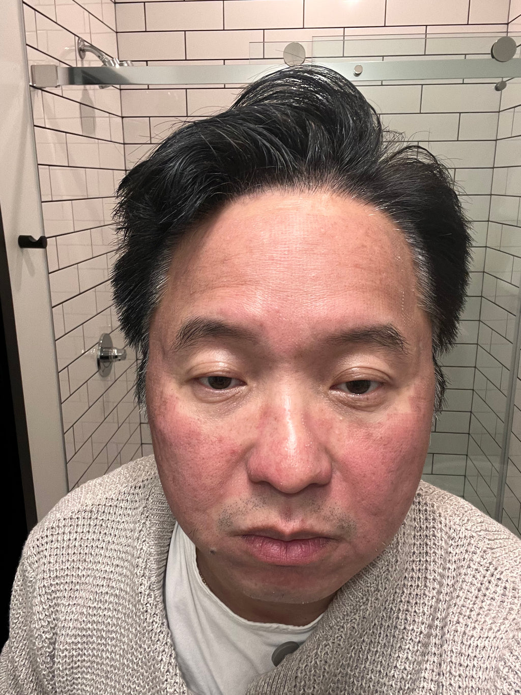 Revo C02 - Post Treatment Day 2 