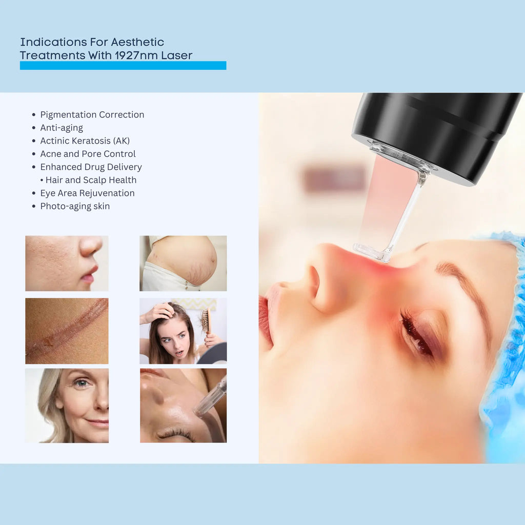 1927 nm Thulium Fiber laser for Precision Skin Rejuvenation with minimal downtime VMS SOLUTIONS SHOP