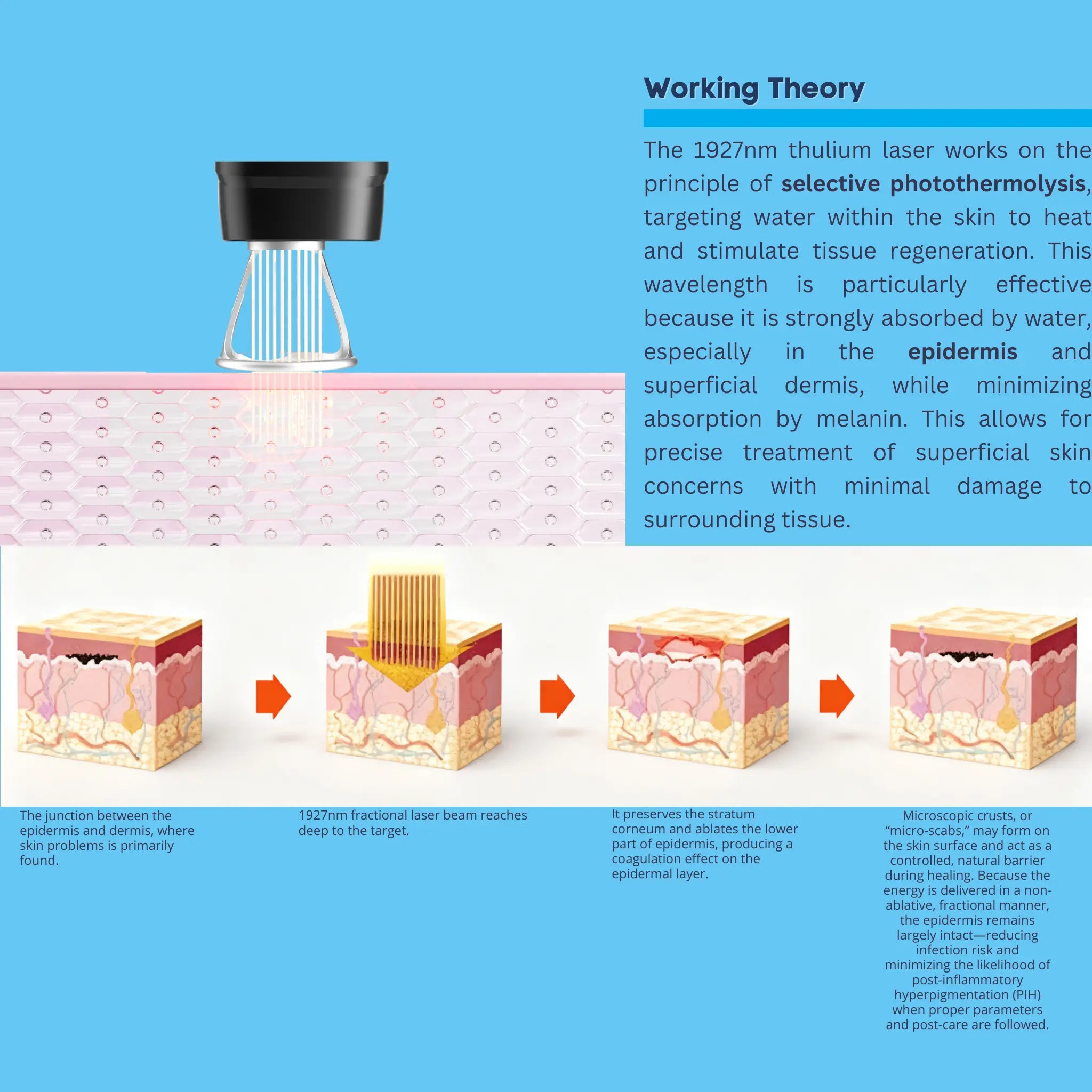 1927 nm Thulium Fiber laser for Precision Skin Rejuvenation with minimal downtime VMS SOLUTIONS SHOP